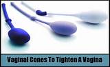 Natural Remedies To Tightening A Vagina