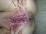 ... huge toys insertions masturbation open pussy shaved pussy speculum