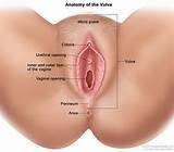 vaginal yeast infection is an infection of the vagina that causes ...