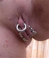 SHOCKING PAIN