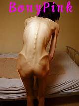 Free Porn Pics Of Anorexic Asian Bony Pink 16 Of 75 Pics