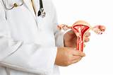 What is Cervical Cancer?