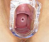These closeup speculum photos are collected from the only and the best ...