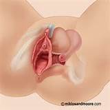 Vaginal Rejuvenation - Tightening Loose Vaginal Muscles