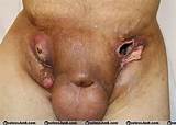 hernia_herpes nude pictures 279601 | UselessJunk.com