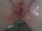 my pussy lips taped up