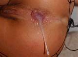Tagged By Users As Close Up Anal Creampie Dripping Creampie Suggest