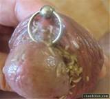 OH MY GAWWWWWWWWD!!! Thereâ€™s a New STD Going Around . . . And YOU ...