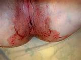 Wife Bleeding Pussy - PERIOD - -/100_1007.jpg