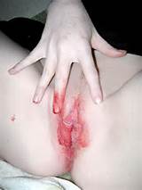 AllStars052.JPG in gallery Bizarre Bleeding Pussy !!! (Picture 2 ...