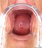 The Cervix â€“ Exploring the Innermost Depths of the Vagina via Close ...