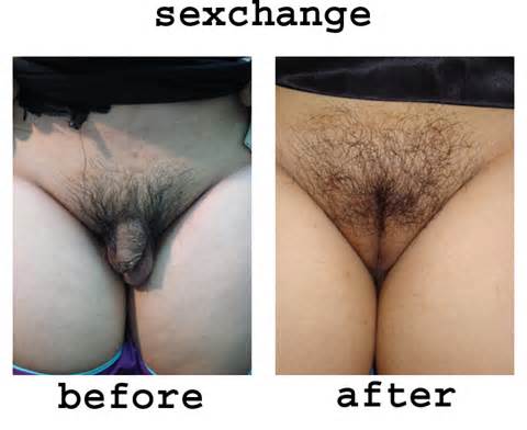 Sex Change Surgery photos (Picture / Article and videos)