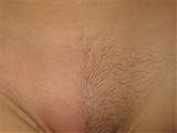 ... cheap - Sugaring NYC Hair Removal - New York Hair Removal Studio