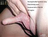Hermaphrodite MUCHOSUCKO Com