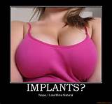 implants-implants-demotivational-poster-1264899192.jpg