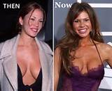 Nikki-Cox-Plastic-Surgery-Before-After.jpg