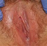 Displaying 18> Images For - Vaginal Infections Types...