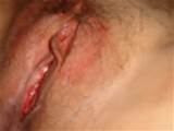 bloody pussy pics see pussy would love know sweet malaysian