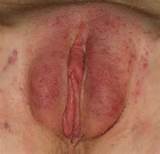 Bruised Pussy
