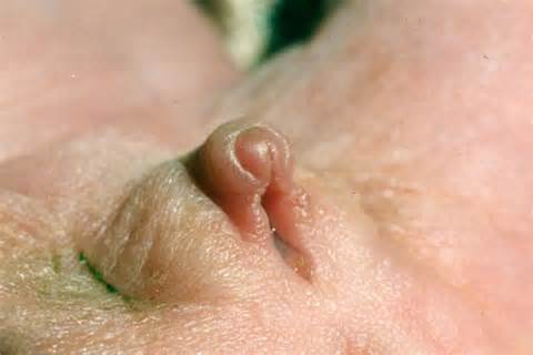 big clitoris versus small penis
