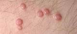 Causes and Cures for Red and Itchy Vaginal Bumps