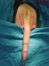 The following images are from a male to female sex reassignment ...